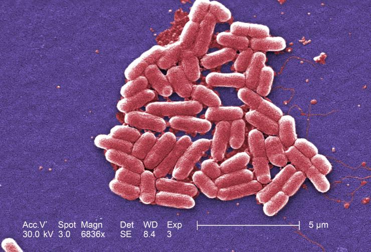 Microscope image of E. coli bacteria