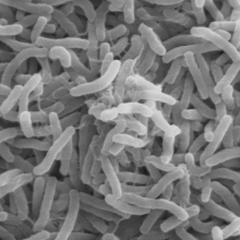 Vibrio cholerae bacteria (Photo Wikimedia Commons)