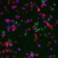 Microscope image of Salinibacter ruber