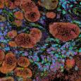 Images of fluorescent cells in orange, blue, purple, pink, and green are shown on a black background. 