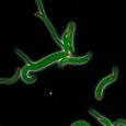 E. coli cells under stress